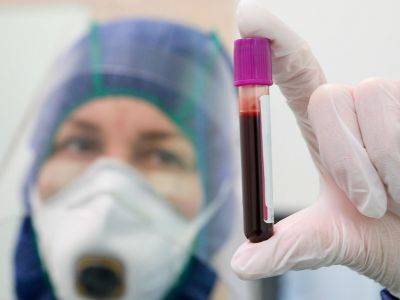 "Инвитро" приостановила тестирование на антитела из-за дефицита реагентов
