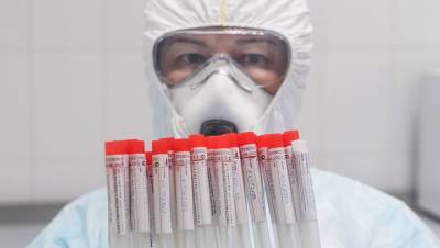 «Инвитро» заявила о приостановке тестирования на антитела к COVID-19