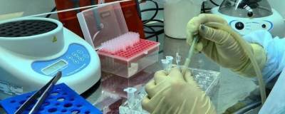 В «Инвитро» приостановили тестирование на антитела к ковиду по причине нехватки реагентов