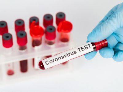 Правительство выделило 25 млрд рублей на лечение коронавируса в регионах