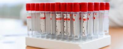 Новый тест на эффективность антител к коронавирусу запустили в России
