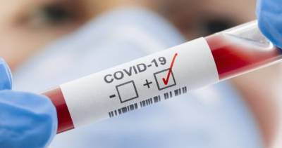 На Луганщине лабораторно подтверждено пять новых случаев COVID-19