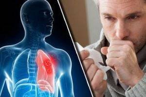 Не сдерживайте кашель: как правильно лечиться