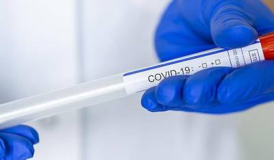 ФАС проверит рост цен на ПЦР-тесты и анализы на антитела к COVID-19