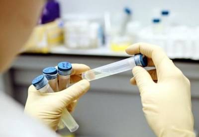 В Украине выявили 182 новых случая коронавируса