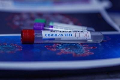 В Татарстане за сутки подтвердили 38 случаев коронавируса