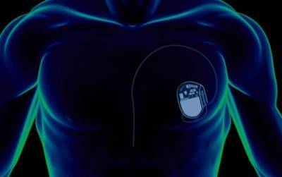 Учёные изобрели растворяющийся в организме кардиостимулятор