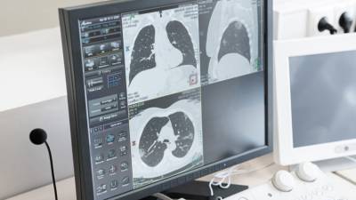 В Москве начнут использовать ИИ для диагностики остеопороза и ишемической болезни сердца