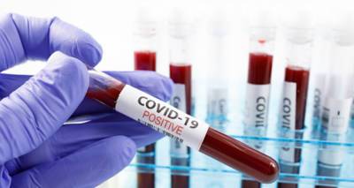 Зарегистрировано 18 новых случаев инфицирования коронавирусом