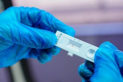 В Минздраве призвали не сдавать на антитела перед вакцинацией от COVID-19