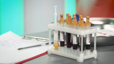 Как самостоятельно расшифровать общий анализ крови