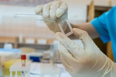 Еще 157 случаев коронавируса выявили за сутки в Волгоградской области