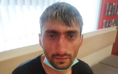 В Киеве избили антимайдановца "Топаза"