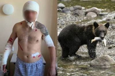 "Больше никаких рыбалок!": после встречи с медведем сахалинец выжил, оставшись без части скальпа