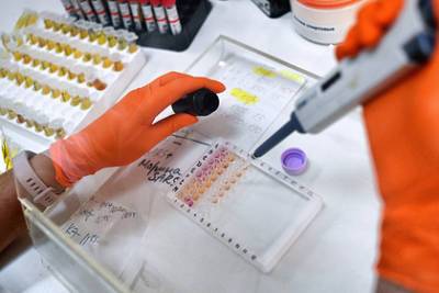 В России выявили 9429 новых случаев коронавируса