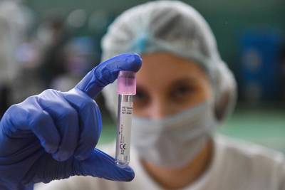 Тест на антитела после прививки «ЭпиВакКороной» разрешили делать в частных лабораториях