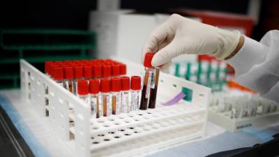Более 70% тестов на коронавирус выполняются в России за счёт бюджета