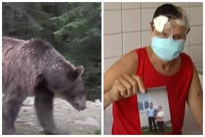 "Медики собирали его по частям": медведица набросилась на мужчину и отгрызла ему пол-лица, видео