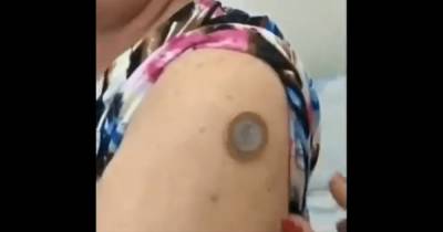 В НИИ "Гамалеи" рассказали, почему к месту вакцинации от COVID-19 примагничиваются металлы (видео)