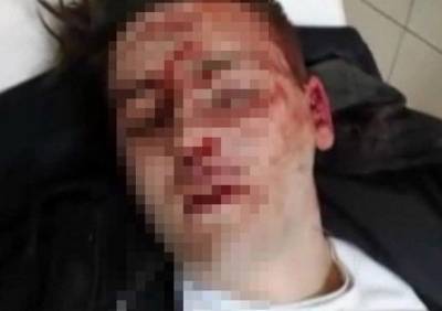 Уголовное дело об избиении в рязанском Svoboda прекращено