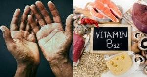 Покалывание рук – первый сигнал дефицита витамина B12