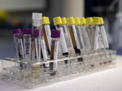 Ученые: Анализ крови может показать, помогает ли сразу лечение против рака