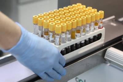 В столице выявили 7 597 новых случаев коронавируса
