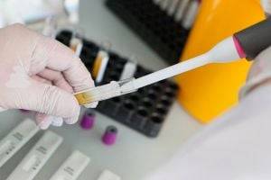 В Украине ПЦР-тесты на коронавирус подделывают частные лаборатории