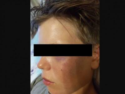 В Киргизии 9-летнего мальчика две недели избивали за то, что он русский