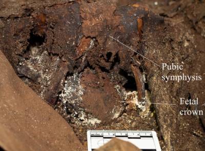 Археологи нашли «родившую в гробу» финскую аристократку