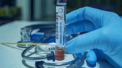 За минувшие сутки в Ленобласти выявили 246 новых случаев коронавируса