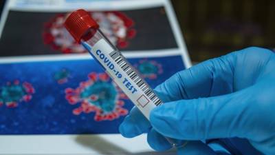 Ученый РАН назвал альтернативный способ защиты от коронавируса