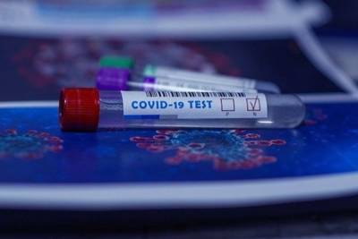 За сутки у 52 жителей Татарстана диагностировали коронавирус