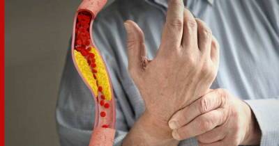 Симптомы высокого холестерина: пальцы рук могут сигнализировать об опасном состоянии