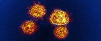 Штамм коронавируса Лямбда распространился в 29 странах. Что он нем известно