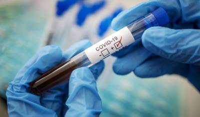Более 188 млн человек в мире заразились коронавирусом