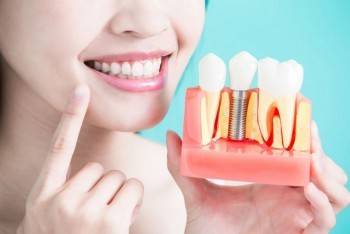 Из чего складывается качественная, эффективная и безболезненная имплантация зубов?