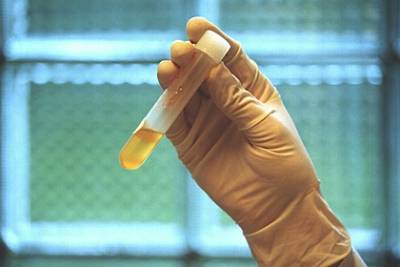 В Китае снова выявили случай заражения человека птичьим гриппом