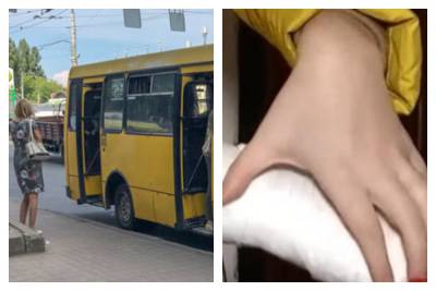 Девочке зажало руку дверью автобуса: водитель вместо помощи начал материться, фото