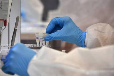 ФМБА назвали сроки начала клинических исследований вакцины от COVID-19
