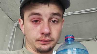 Андрей Александрович - Едва не лишился глаза: пробка из-под минералки выстрелил мужчине в голову - novostiua.news - Украина