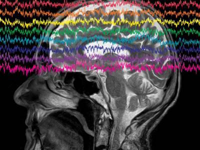 Исследователи прочитали фразы по мозговым волнам парализованного человека
