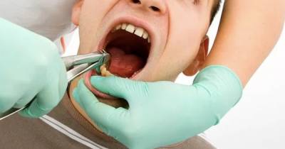 Женщина выдала себя за дантиста и вырвала 13 зубов изо рта пациента