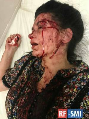 В Днепре избили известную активистку Наталью Эшонкулову