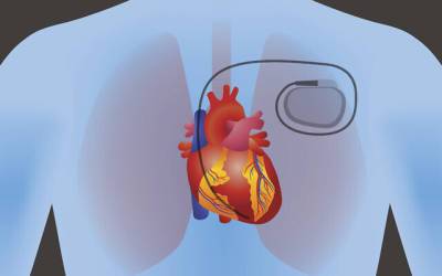 Израильская нанотехнология использует энергию тела для выработки энергии для кардиостимуляторов