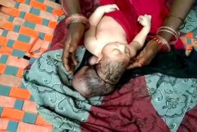 Воплощение Бога на Земле: в Индии ребенок родился с тремя головами, фото