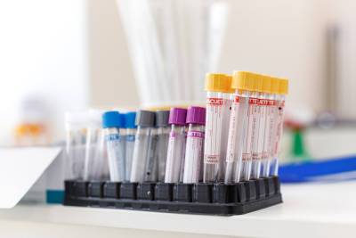 За неделю коронавирус нашли у 14 пациентов, которые сдали тест в псковской клинике