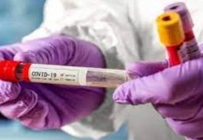 В Украине 696 новых случаев коронавируса