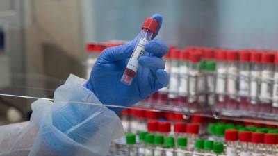 В России за сутки выявили 23 218 случаев коронавируса