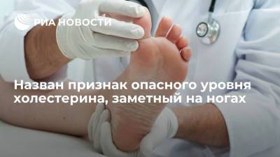 Daily Express: наросты на пальцах ног могут быть признаками высокого уровня холестерина в крови